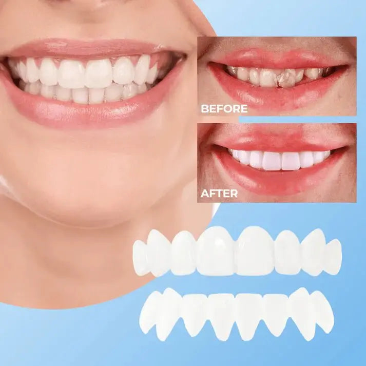 SNAP - ON SMILE Carillas dentales con clip - The Box Spain